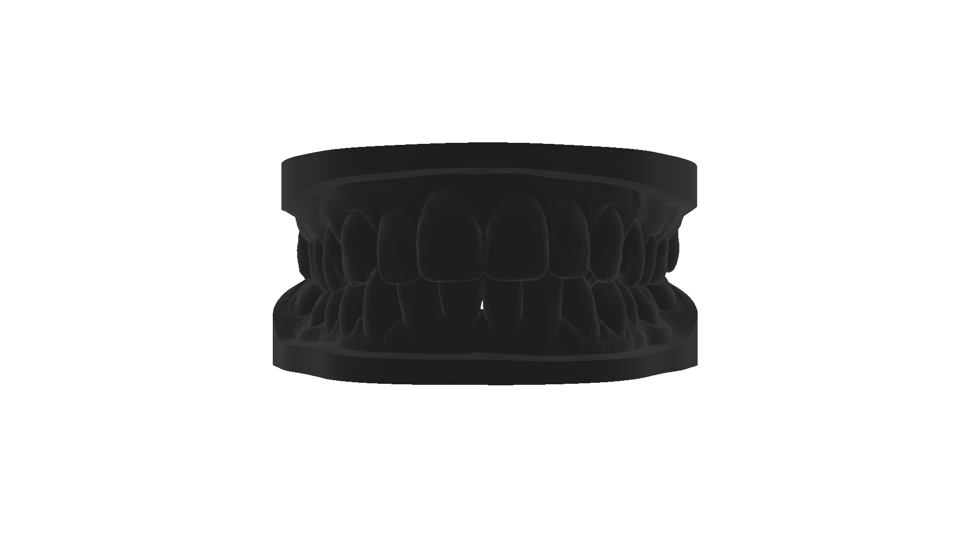 GRILLZ (Please discuss design before purchase)